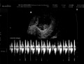 CNA Training Lancaster PA 3562.jpg